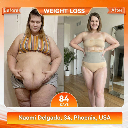 👙𝐎𝐟𝐟𝐢𝐜𝐢𝐚𝐥 𝐁𝐫𝐚𝐧𝐝 𝐒𝐭𝐨𝐫𝐞 | Pryxo™ 𝟐𝟎𝟐𝟔 𝐌𝐨𝐫𝐢𝐧𝐠𝐚 & 𝐁𝐞𝐫𝐛𝐞𝐫𝐢𝐧𝐞 𝟒-𝐈𝐧-𝟏 𝐌𝐢𝐜𝐫𝐨-𝐏𝐚𝐫𝐭𝐢𝐜𝐥𝐞 𝐒𝐜𝐮𝐥𝐩𝐭𝐢𝐧𝐠 & 𝐅𝐚𝐭-𝐁𝐮𝐫𝐧 𝐒𝐡𝐨𝐫𝐭𝐬