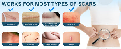 Advanced Scar Gel, Silicone Scar Gel, Treats Old and New Scars, Reduces the Appearance of Scars from, Body, Face, Stretch Marks, Surgical Scar, Keloids, Acne